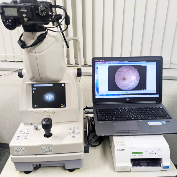 無散瞳眼底カメラ